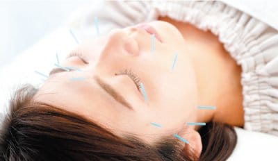 美容鍼灸（フェイシャル）松本市美容鍼灸サロンShinkiのウェブチケット
