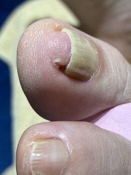 フットネイルケアで足の爪をキレイに ネイル 本格エステ トータルビューティーサロン カリタ奈良 ホテル日航奈良1階 ツクツク ビューティーモバイル ポイントが貯まるサロンの検索予約サイト