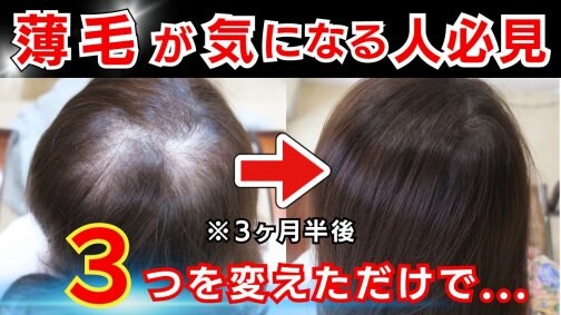この３つがあれば勝手に髪は生えてくる｜東京都渋谷区恵比寿