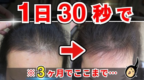 【1日30秒】女性の抜け毛が激減したトレーニング