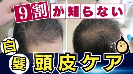 【白髪染めで薄毛改善!?】900事例で結果が出た頭皮ケアについて