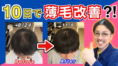 【 薄毛 白髪 女性必見 】失敗しない育毛サロンの選び方