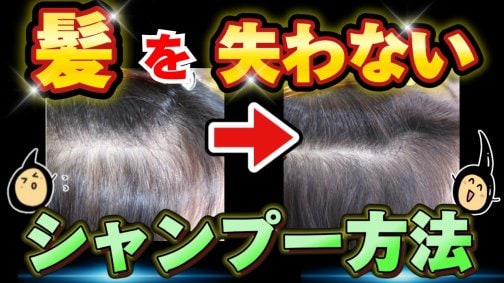 髪を失いたくない!抜け毛が減るシャンプー方法とは?