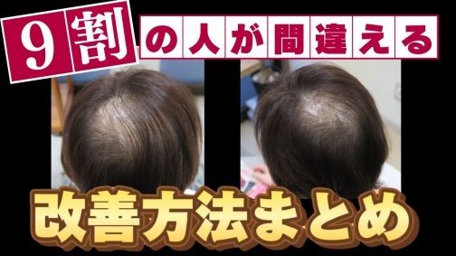 【2024年最新】老けて見られたくない女性の頭頂部薄毛の対策まとめ