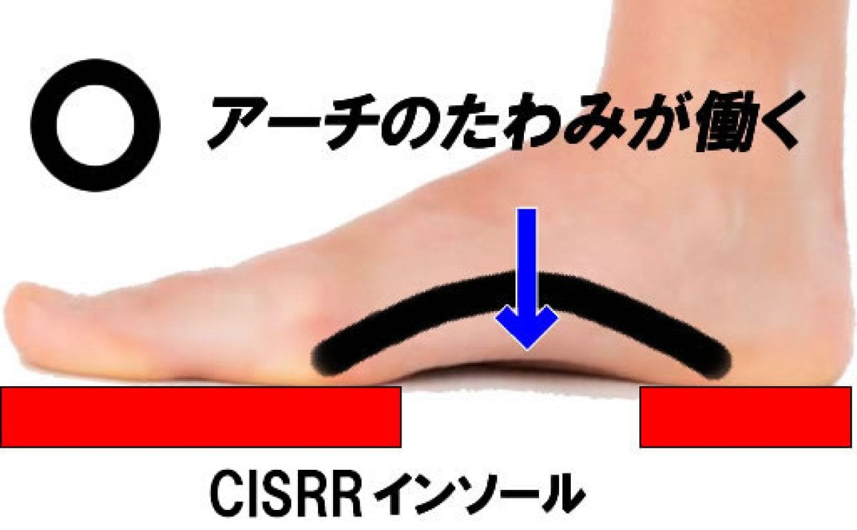 アーチを解放したCISRR（しーさー）は足底筋の機能を発揮させる目的のインソールです。