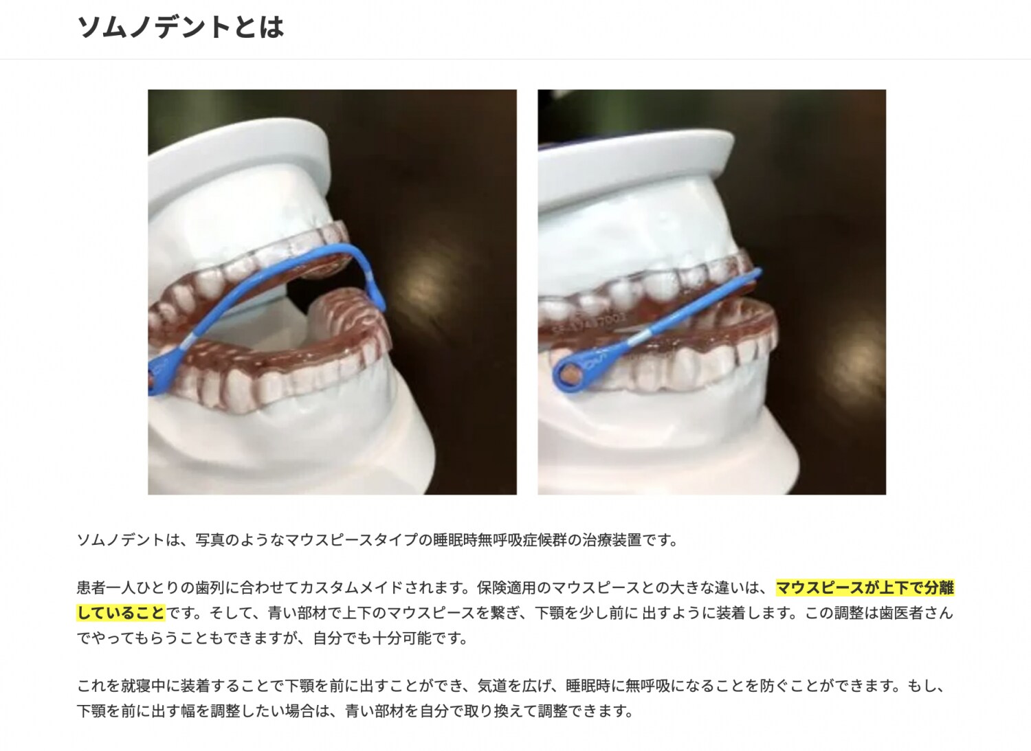 ソムノデントとは