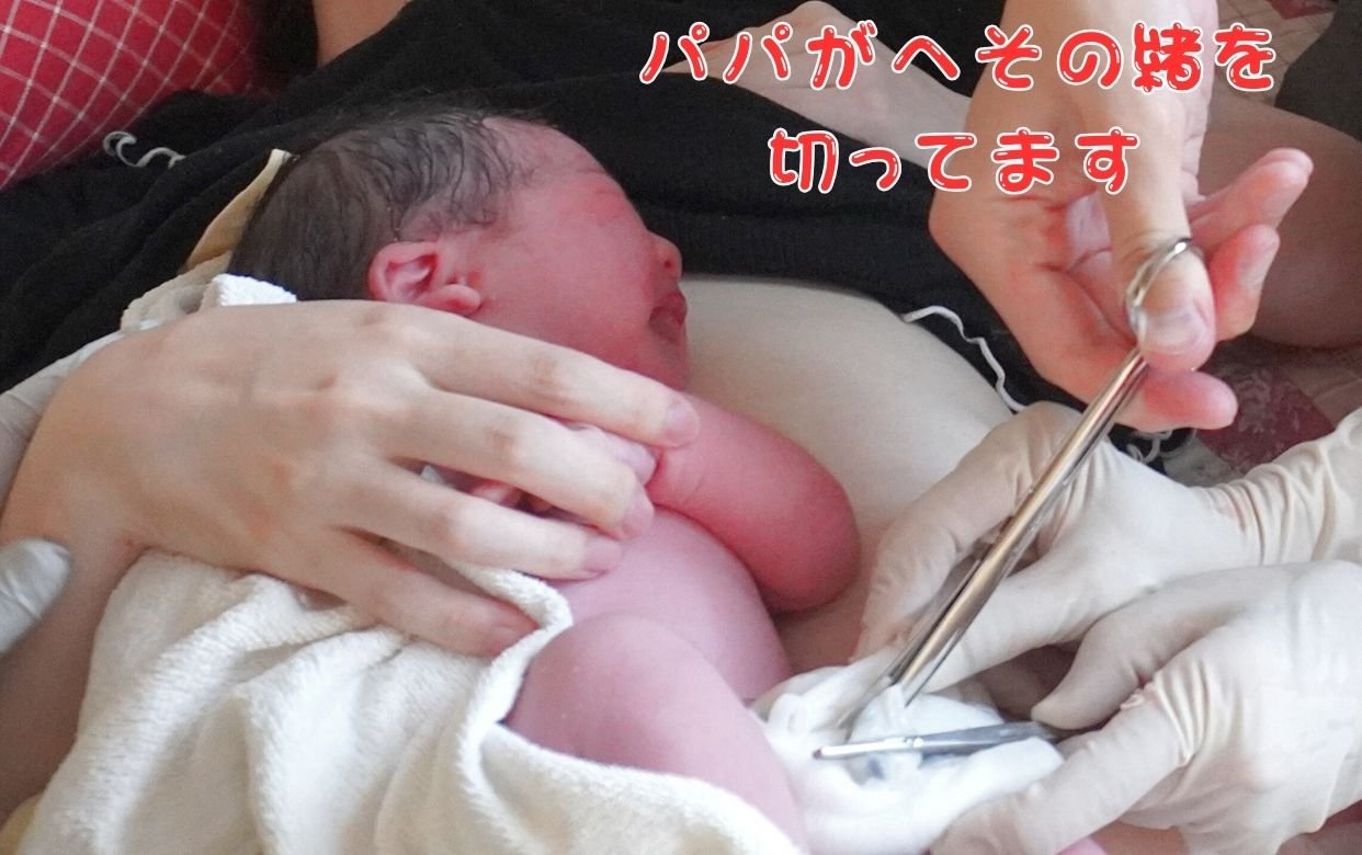 へその緒3