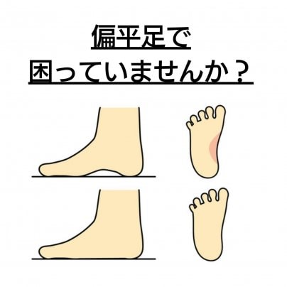 【偏平足】 こんな症状にお悩みありませんか?