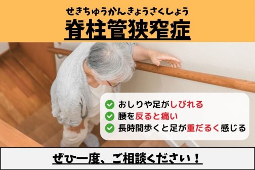 若見え美脚への近道【脚むくみ】×【脊柱管狭窄症】 こんな症状にお悩みありませんか?