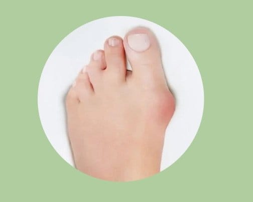 足の耐用年数は⁉️
