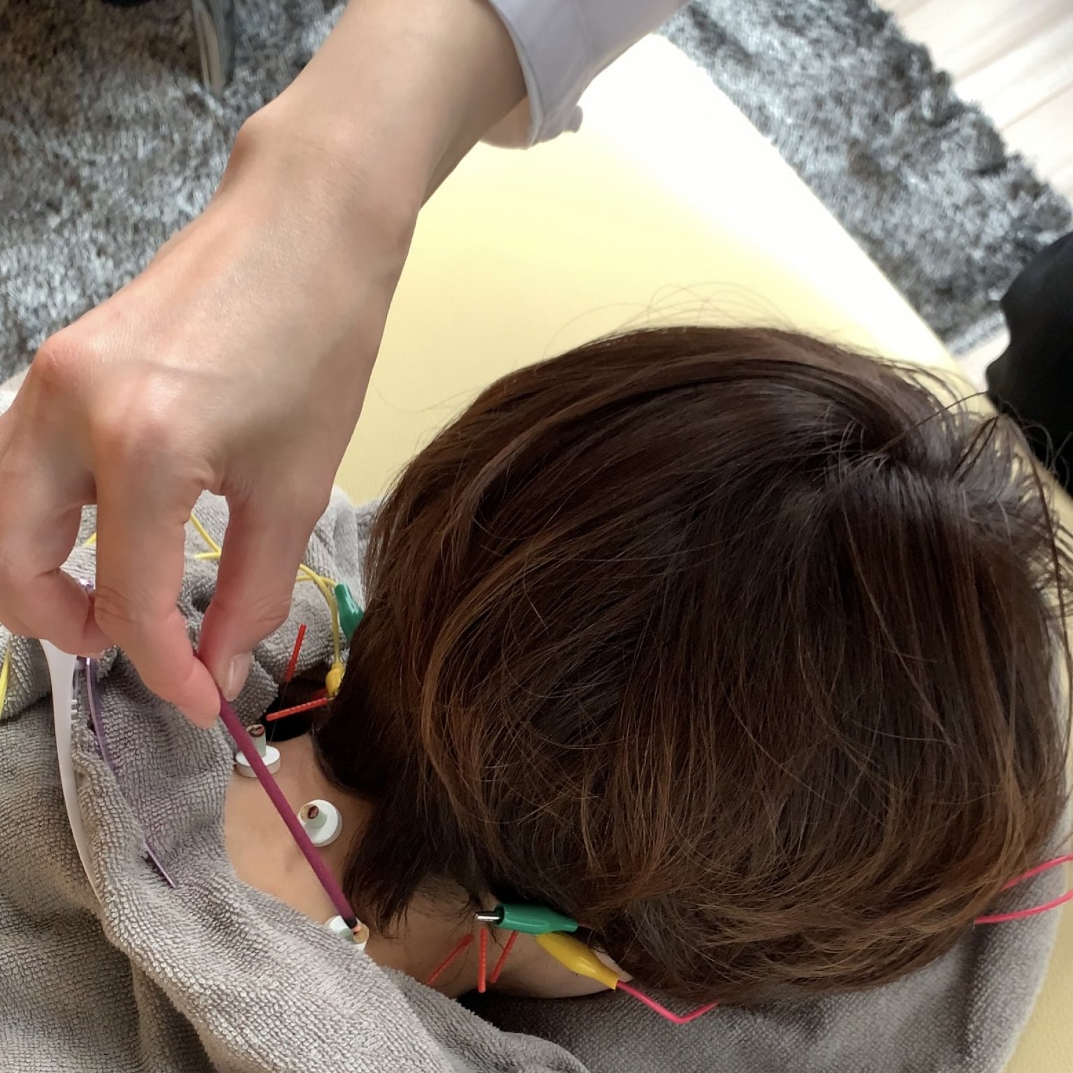 美容鍼灸フェイシャル(60分)