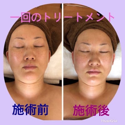 ポイント高還元!!美顔矯正アロマフェイシャル60分 (全てのお客様）