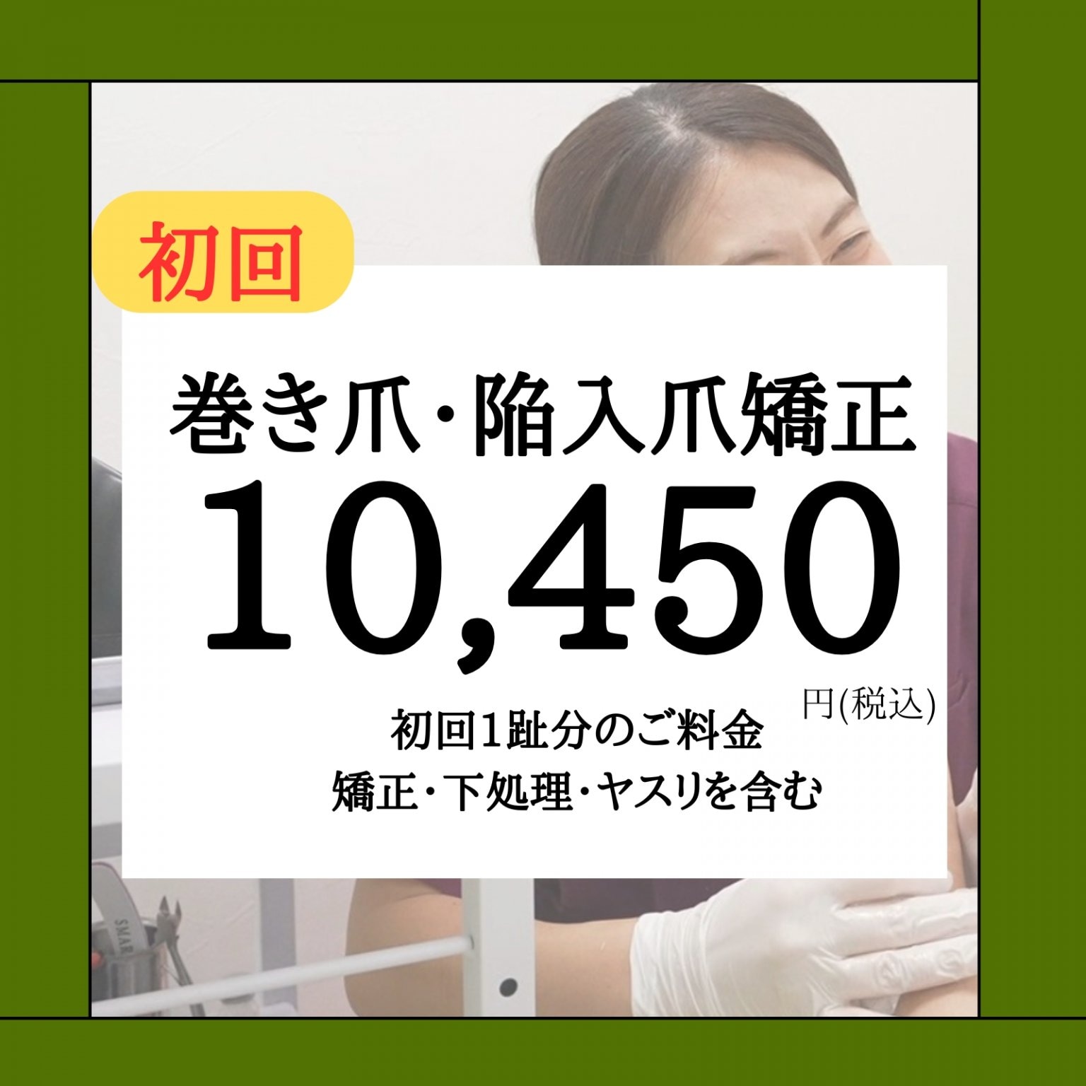 巻き爪矯正施術1趾両側初回限定セット