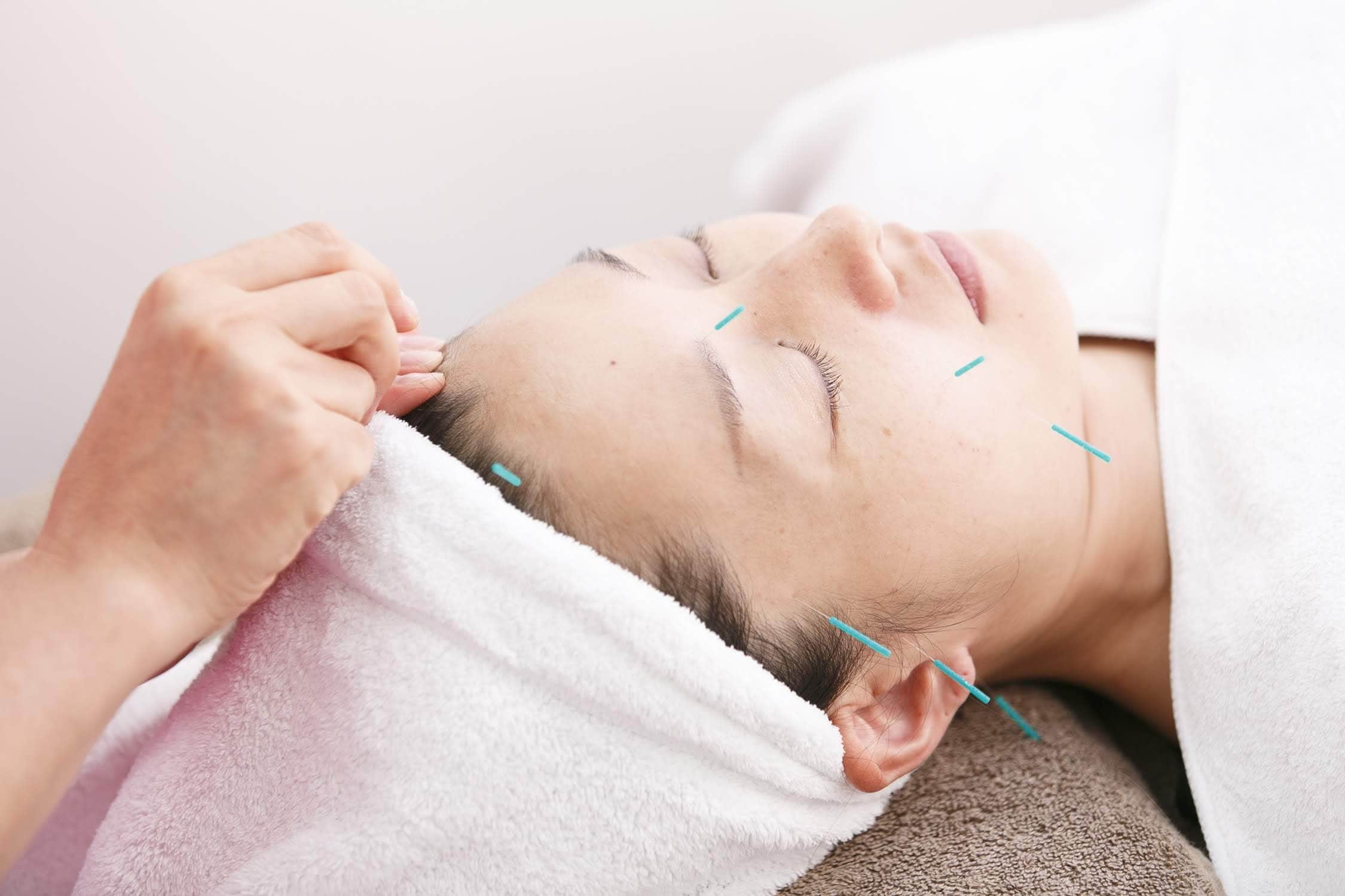 美容鍼 美顔鍼 ems美容フェイシャル 世田谷区下北沢 笹塚 代田 東松原の接骨院 山中はりきゅう接骨院 肩こり 腰痛の治療 交通事故 むち打ち治療 骨盤矯正 日曜日診療 ツクツク ウェブチケット モバイル コトの通販サイト 体験を買える