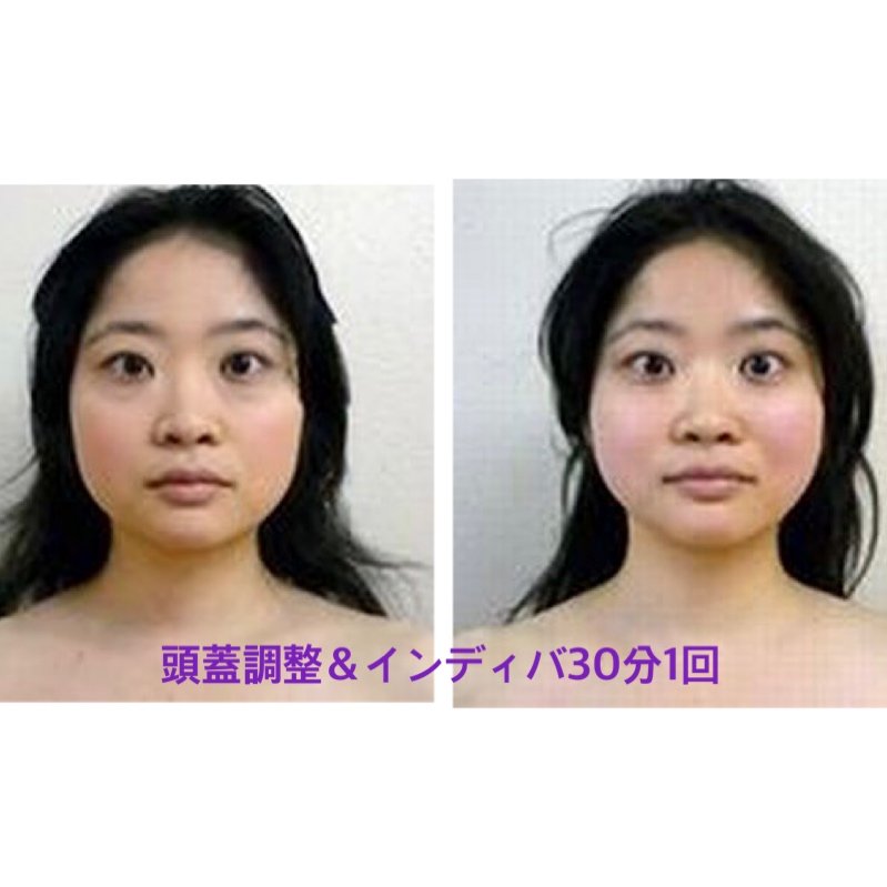 店頭決済専用 再診頭蓋調整 小顔 頭痛 顎関節症 統合失調症 不安症候群等 下北沢駅徒歩1分curar クラル インディバ 温熱施療器 専門サロン くらる整骨院 ツクツク ウェブチケット モバイル コトの通販サイト 体験を買える