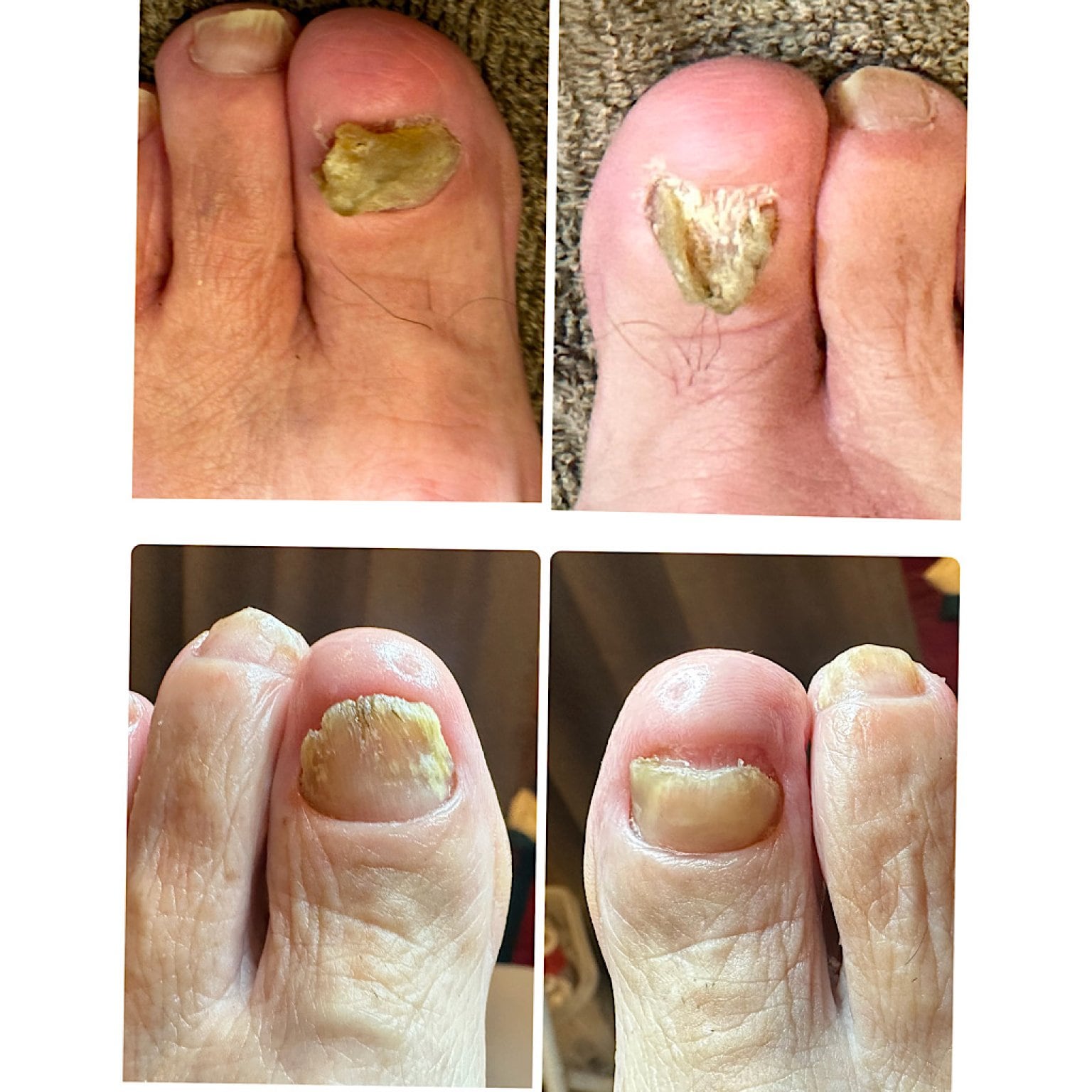 マルシェ用フットケアチケット