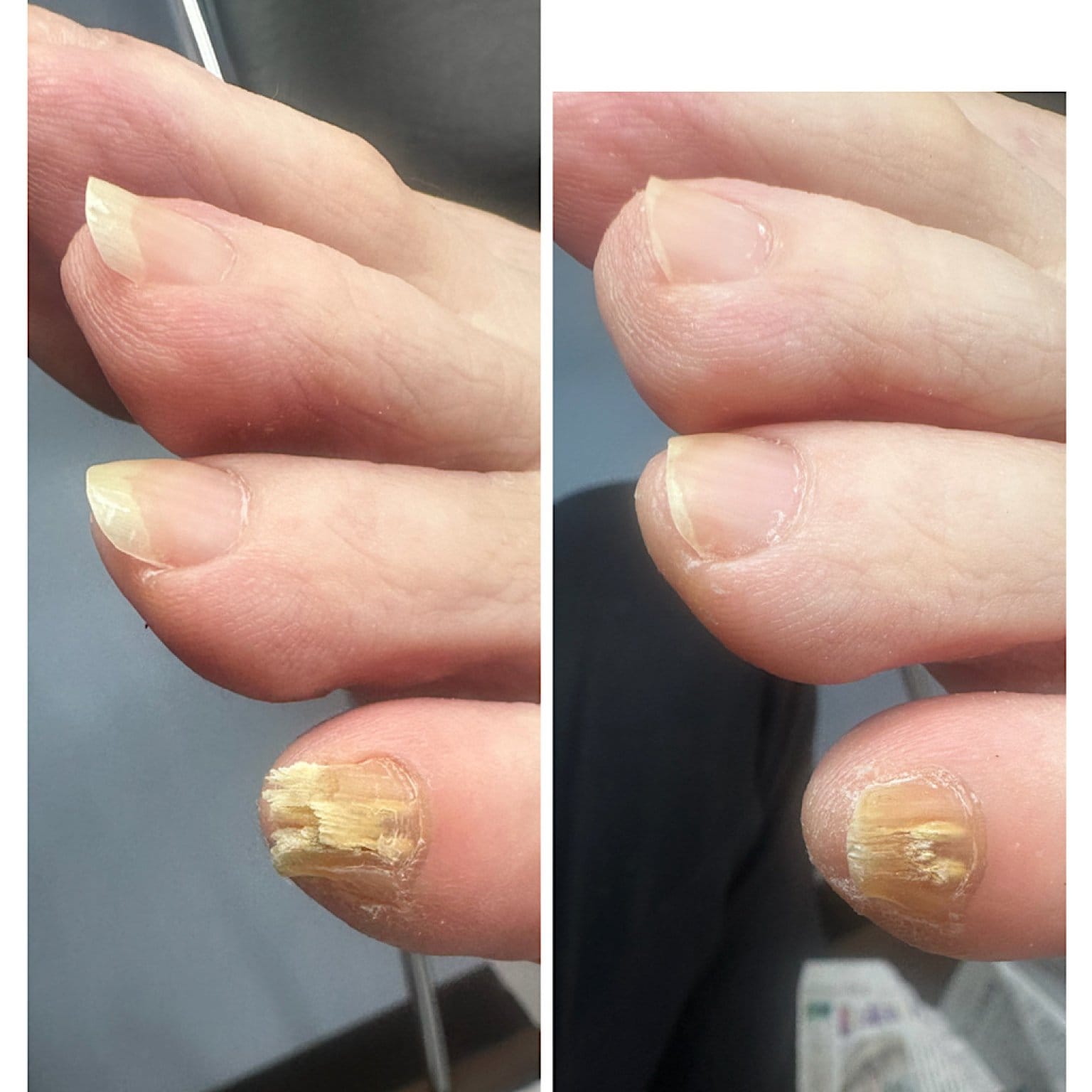 マルシェ用フットケアチケット