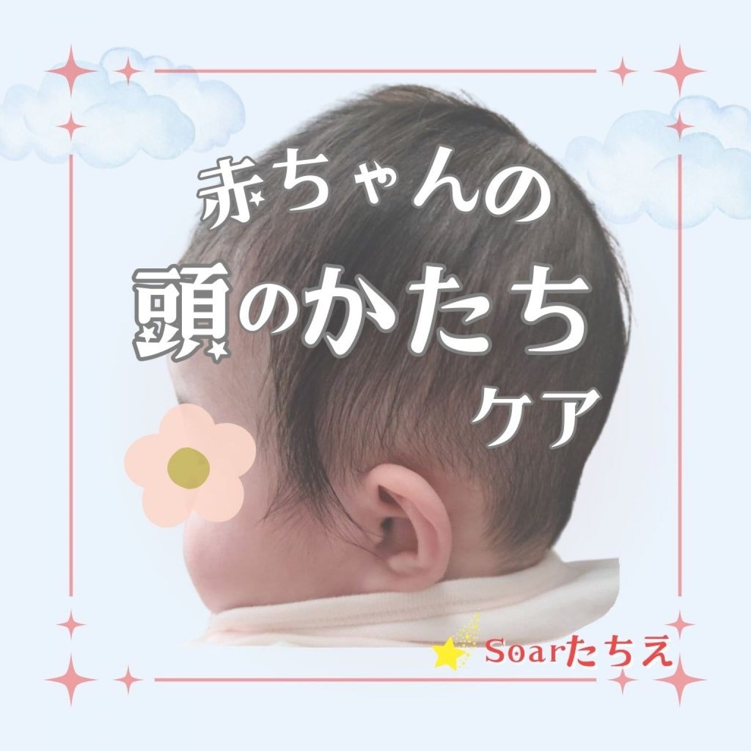 赤ちゃんの頭のかたちケア｜斜頭・短頭（絶壁）・長頭など頭のゆがみでお悩みの方へ｜