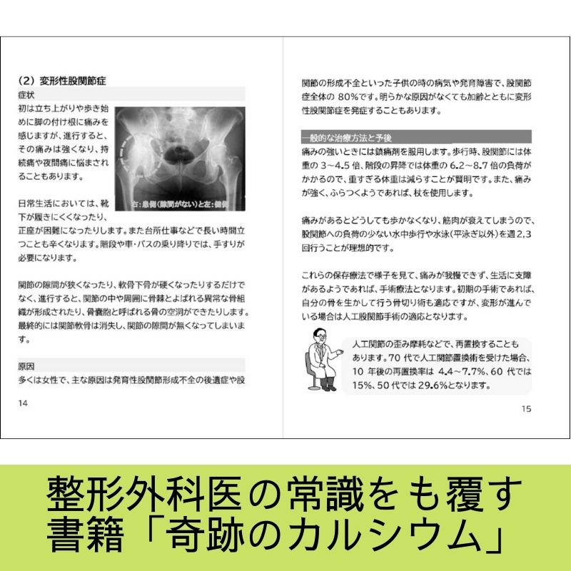 楽天市場】書籍 「カルシウム革命」 健康で長生きは骨で決まる