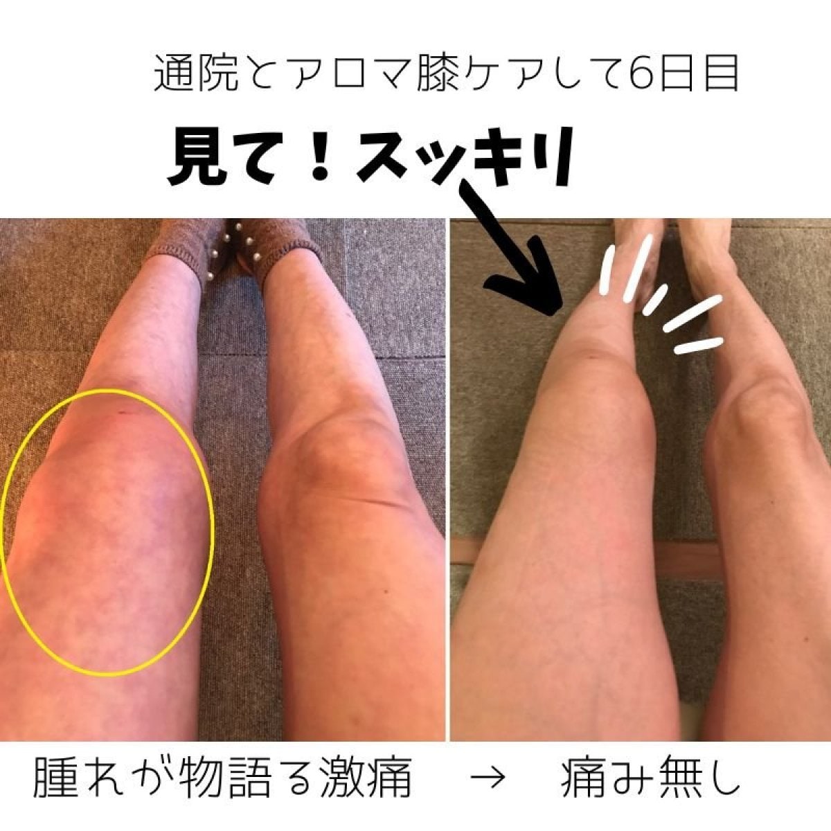 アロマ膝ケアIN大阪　軽やかに歩くたのしみをおもいっきり実感♪