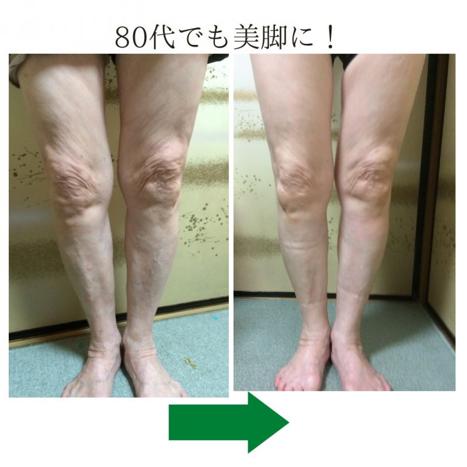 アロマ膝ケアIN大阪　軽やかに歩くたのしみをおもいっきり実感♪