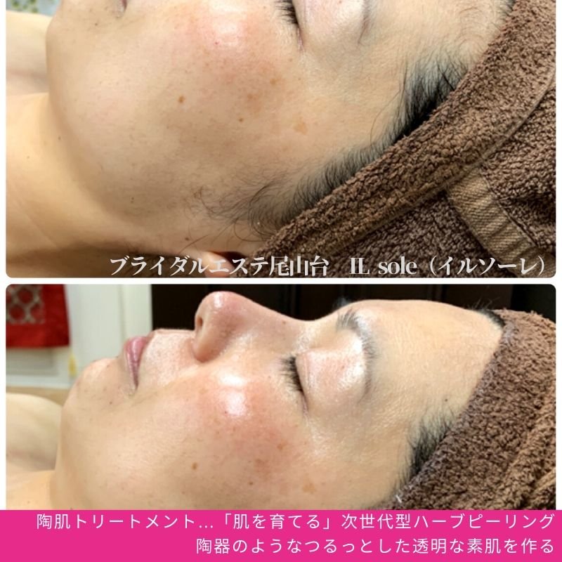 希望に満ちた アレルギー性 骨髄 陶器 ピーリング Eco 2 Jp