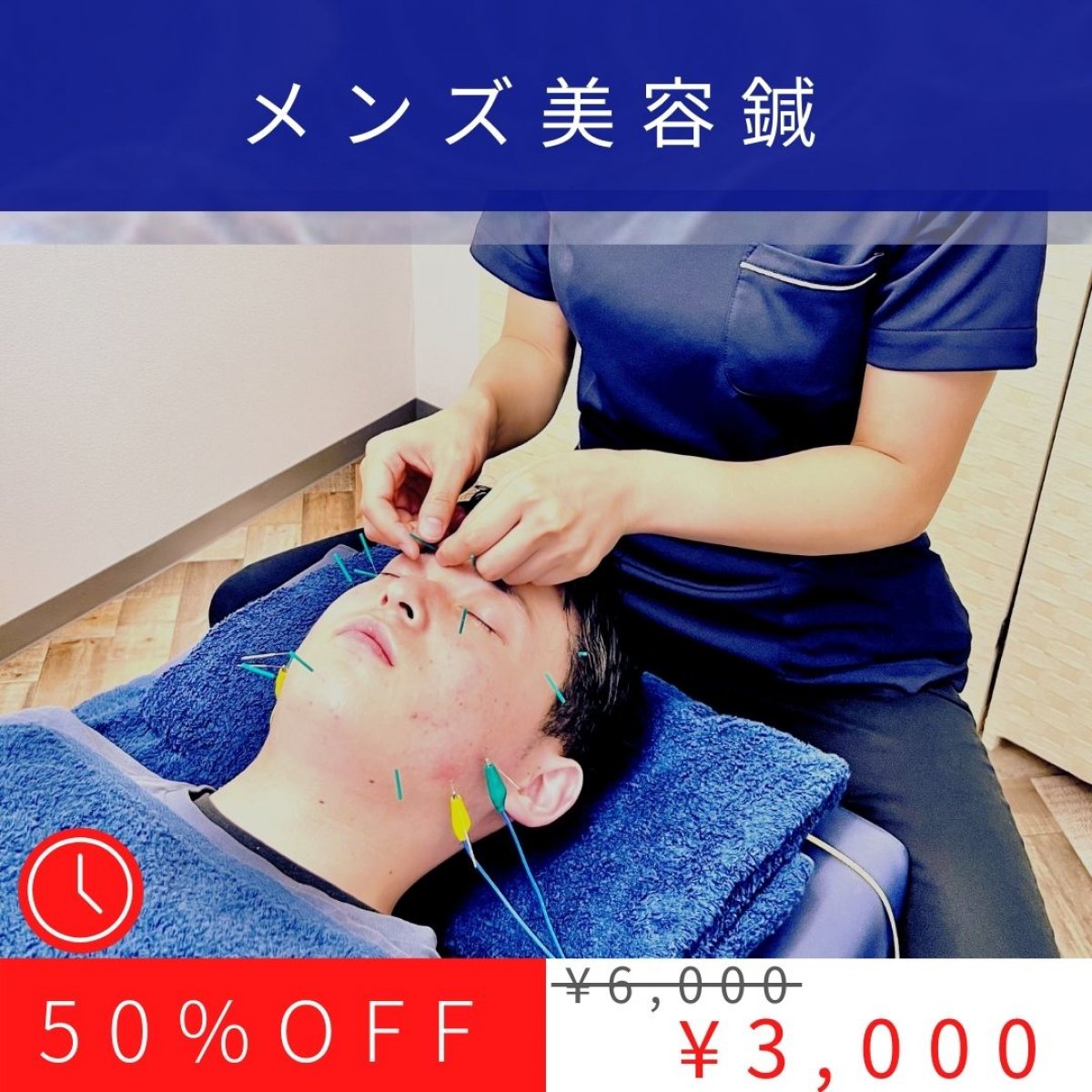 メンズ美容鍼 体験 鳥栖ふるかわ整骨院