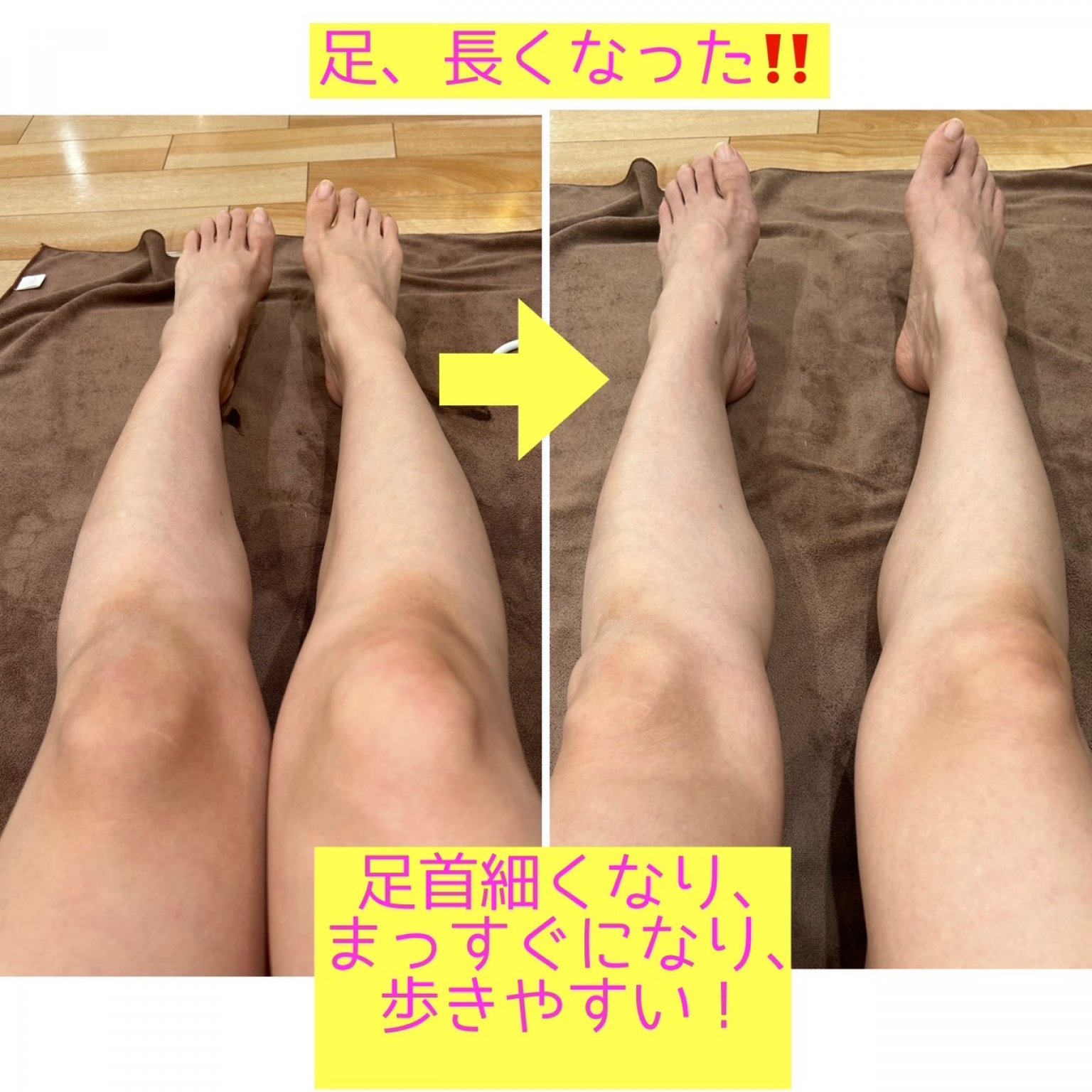 【健康エステ】更年期メニュー　（低周波高周波で気になるところほぐして痩せる）