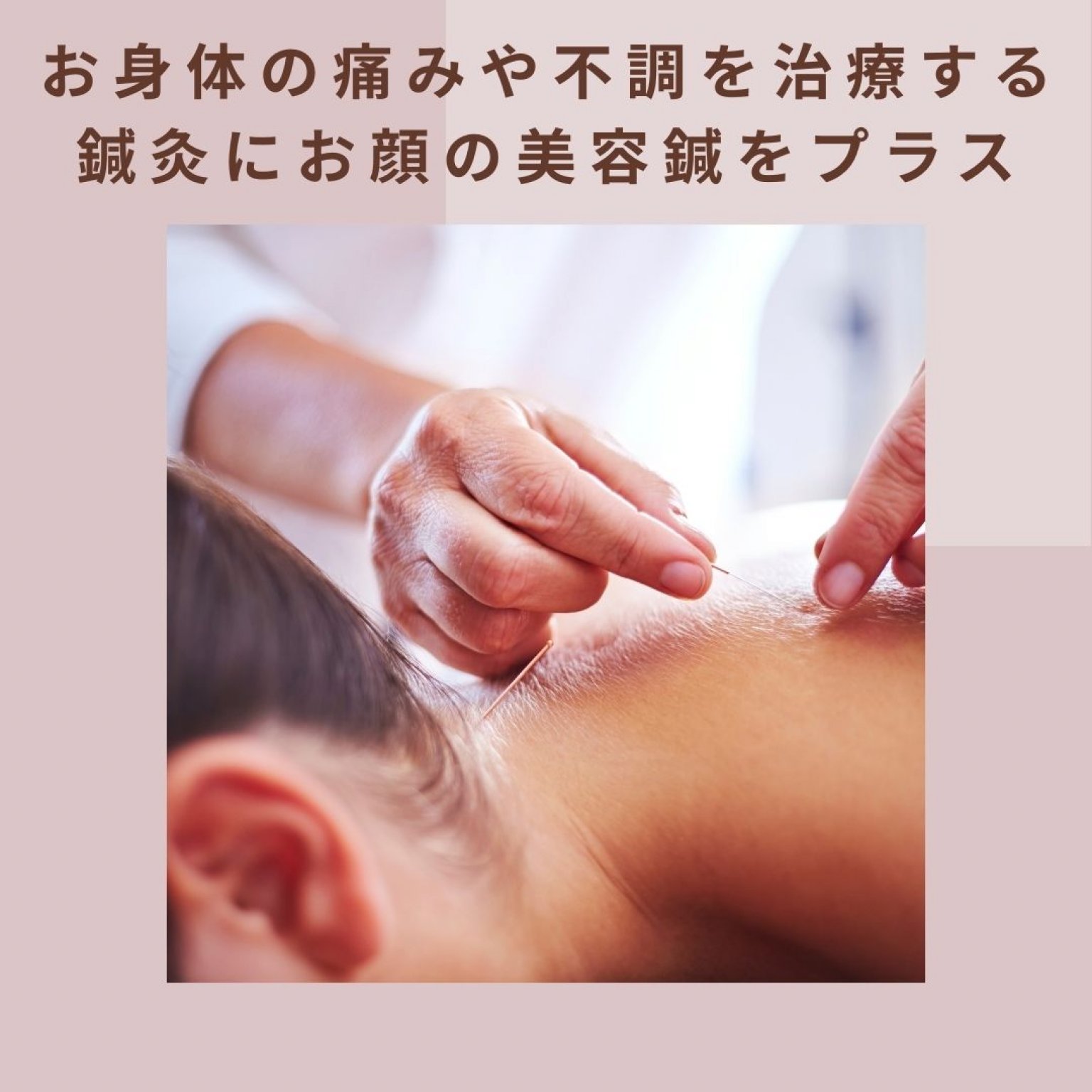 美容鍼＋全身鍼灸45分