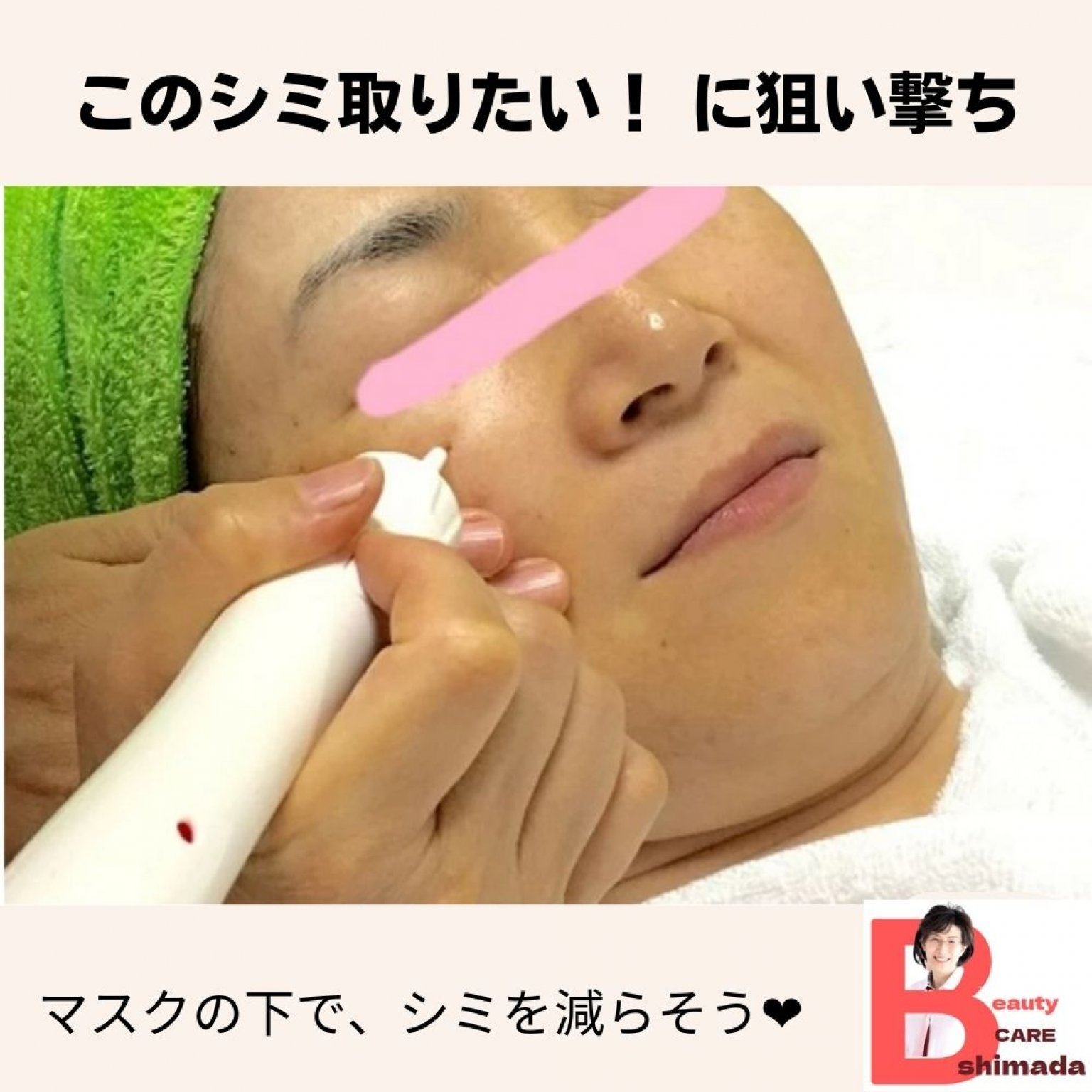 【初回用】介護脱毛(40代からのVIO脱毛）