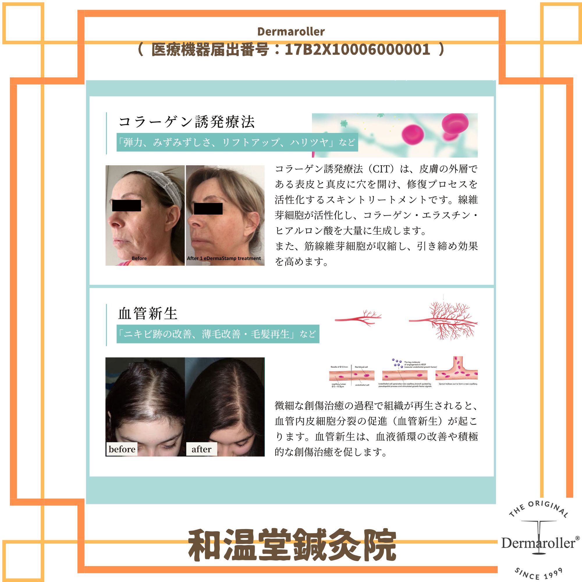 ダーマローラーHC902（送料無料）