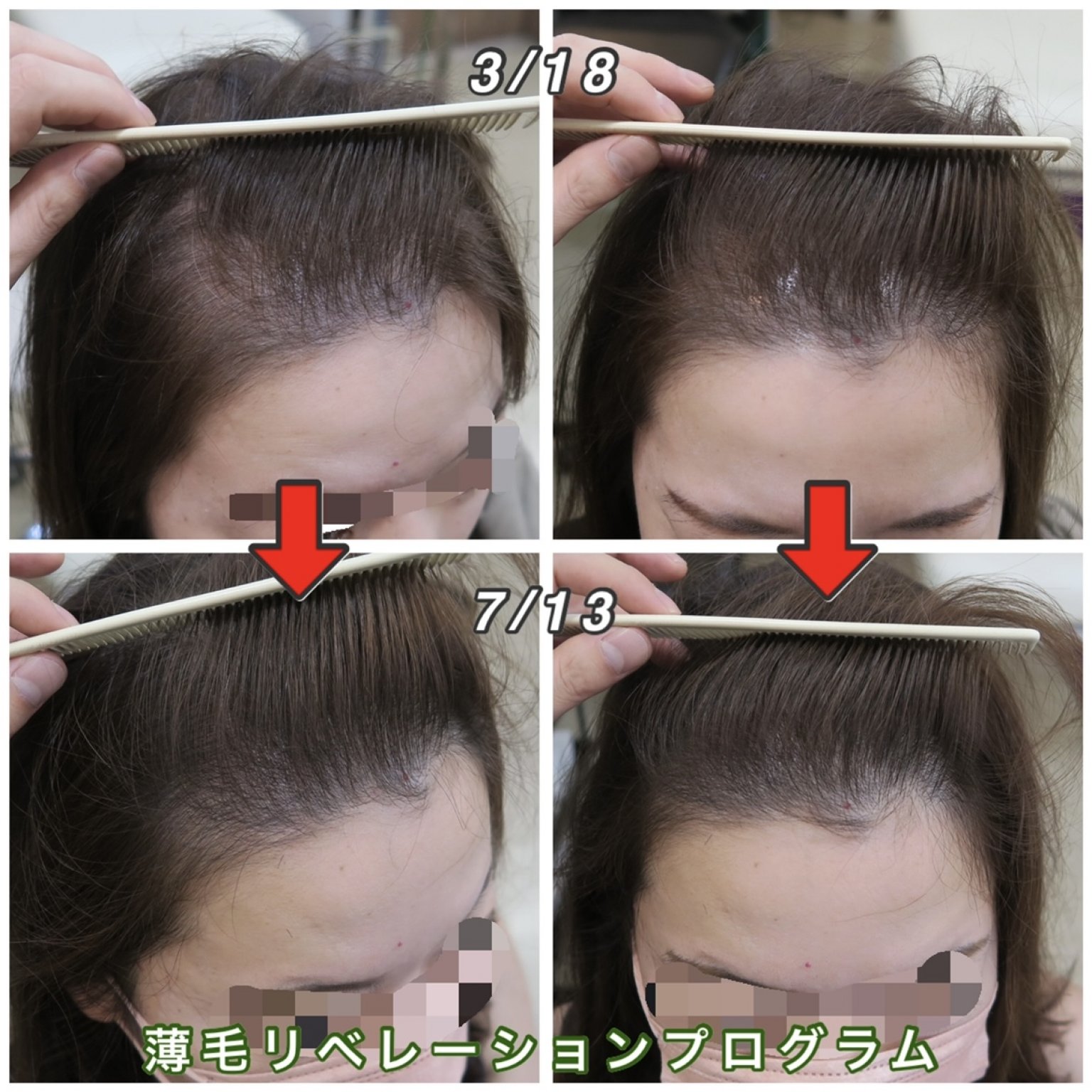 ２０代専用zoomオンライン個別相談会