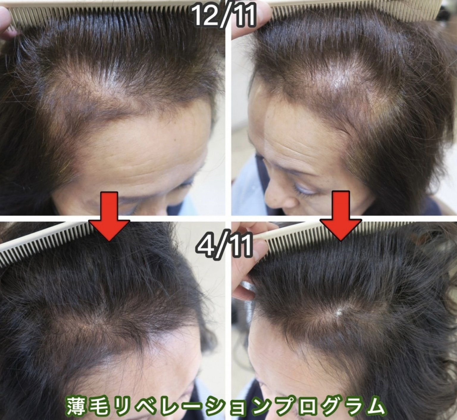 ４０代専用zoomオンライン個別相談会