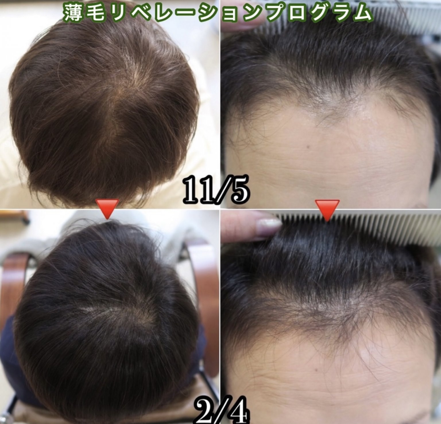 ４０代専用zoomオンライン個別相談会