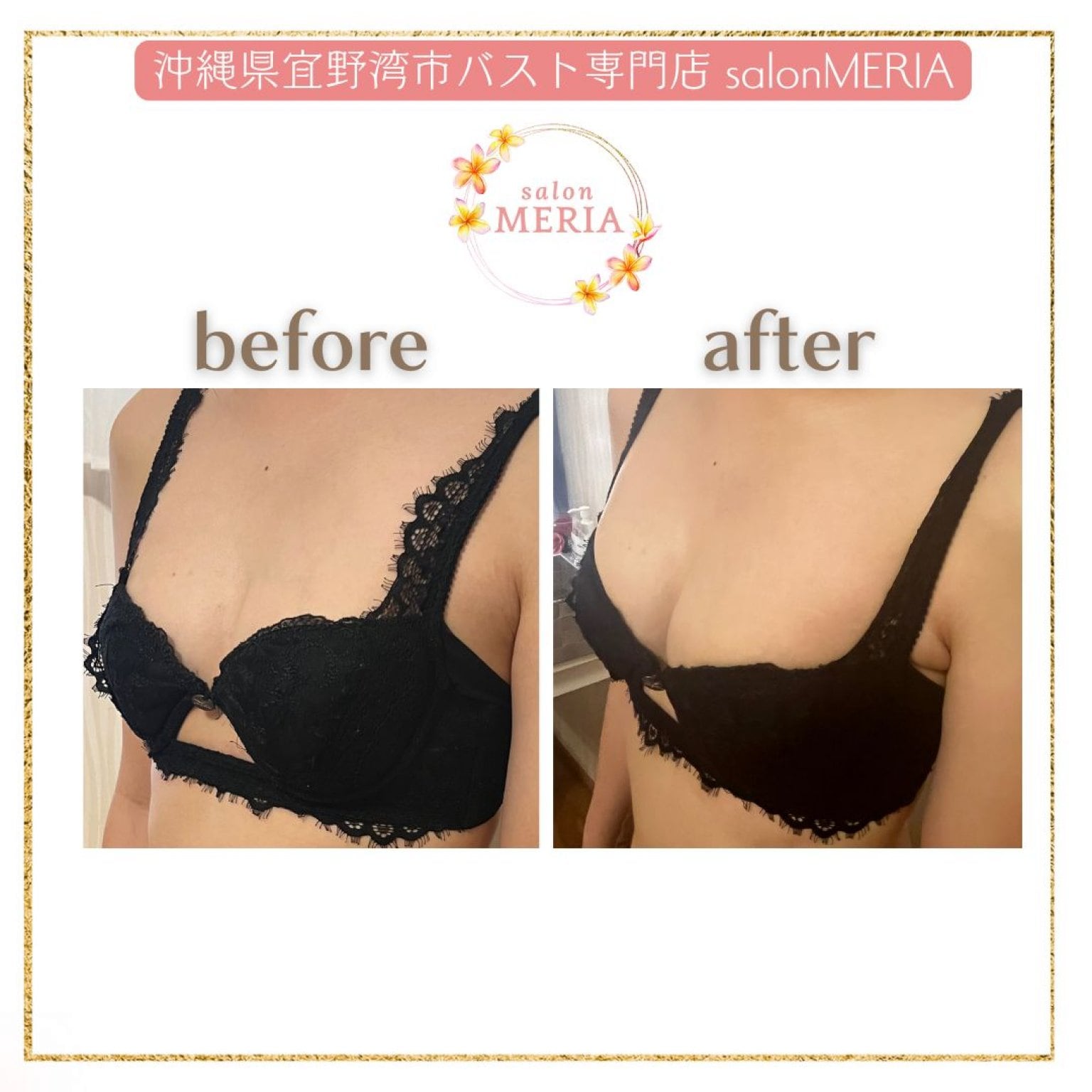 バストのお悩み相談付き下着フィッティング