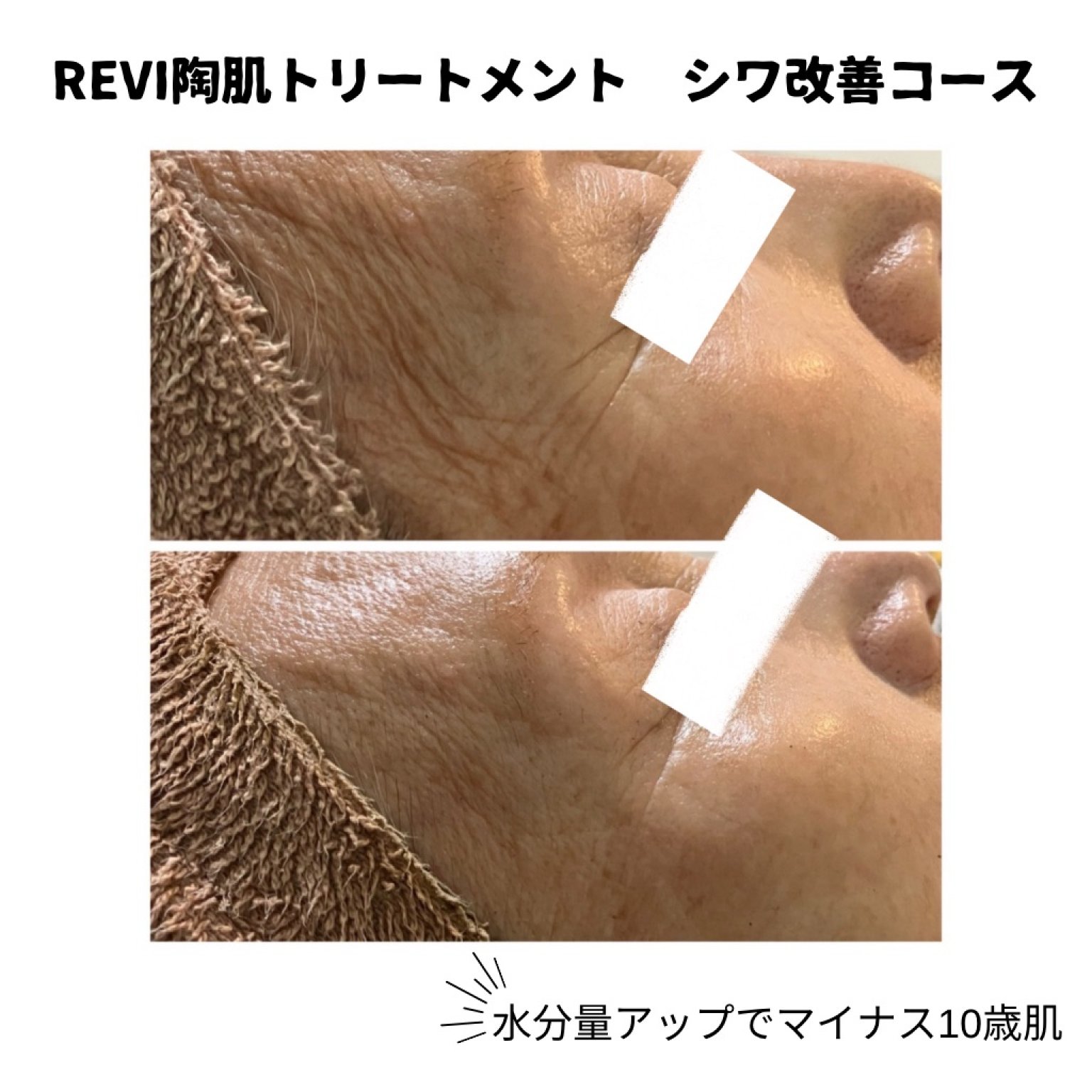 ラグジュアリーコース REVI陶肌トリートメント ￥36,650