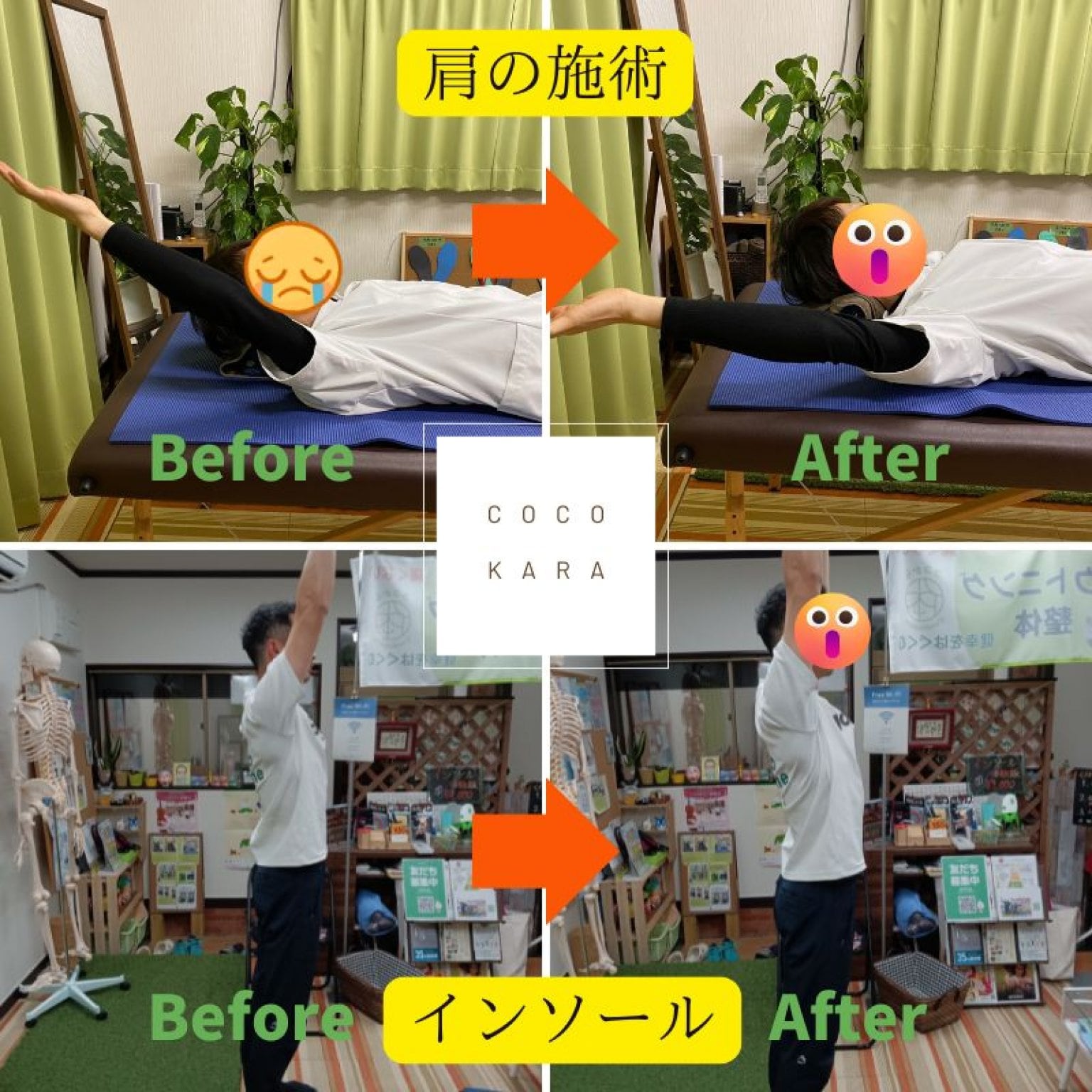 立ち仕事・事務職の方/スポーツをされる方/肩腰足などの全身でお悩みの方に(完全オーダーメイドインソール)現地払い限定