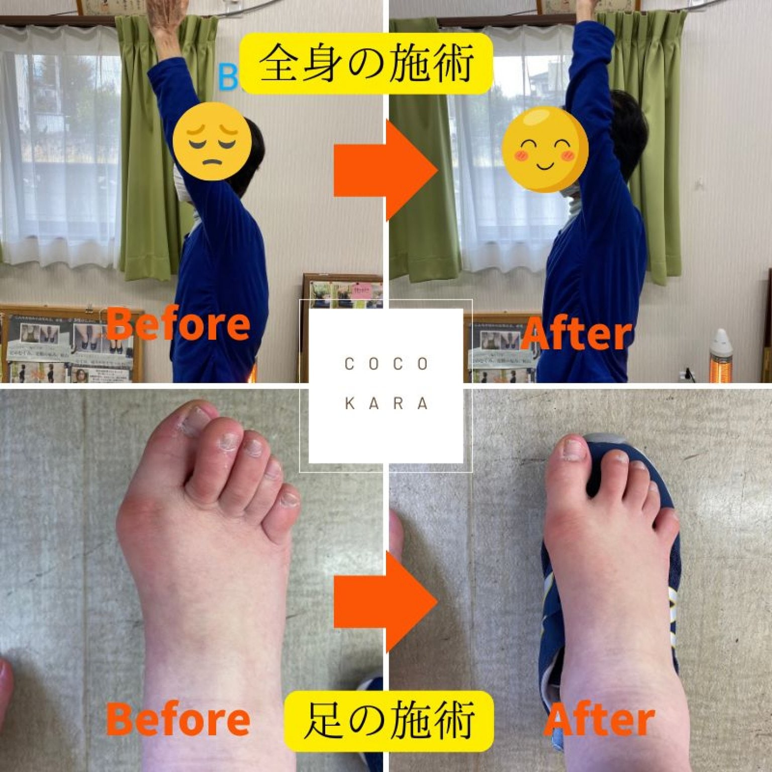 立ち仕事・事務職の方/スポーツをされる方/肩腰足などの全身でお悩みの方に(完全オーダーメイドインソール)現地払い限定