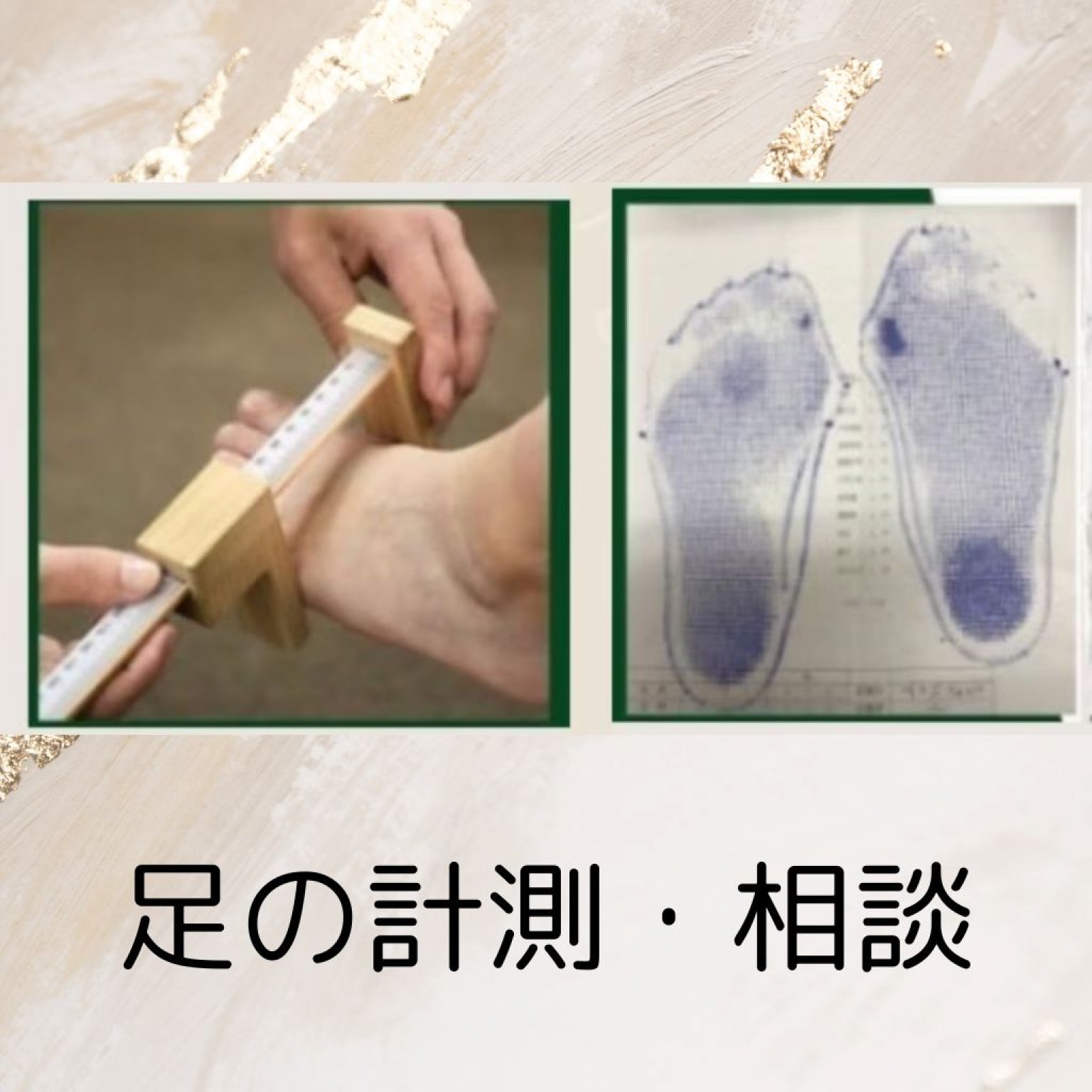 足の計測・相談