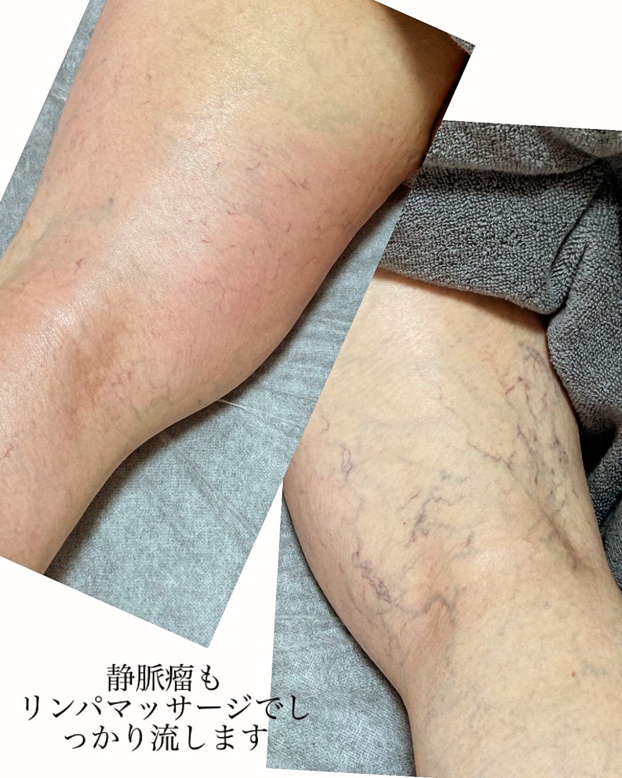 大切な方のご紹介ありがとうございます！ご紹介者様への感謝チケット