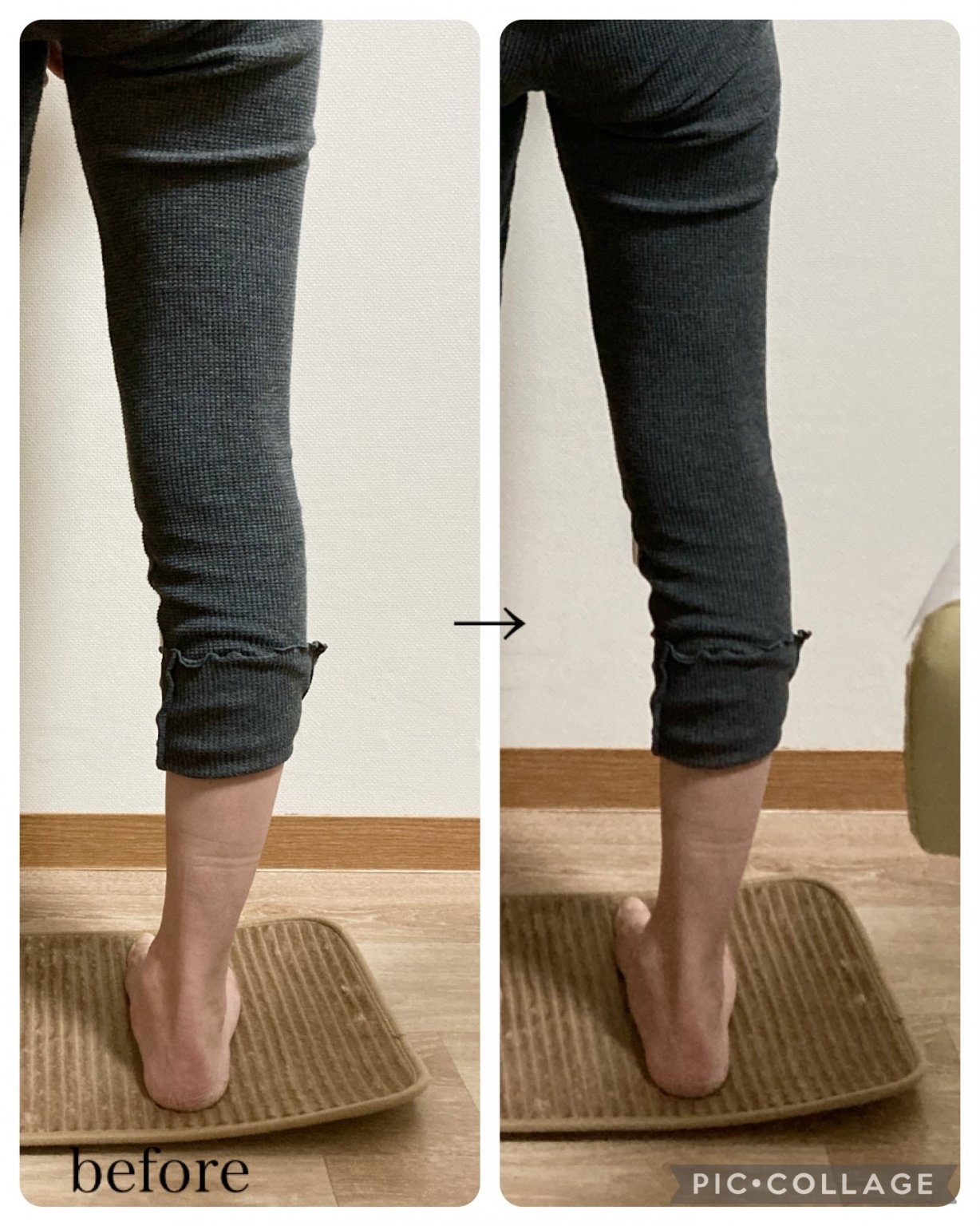 ★人気No1★ 外反母趾・寝指・扁平足・巻き爪・足のトラブル改善フットケア　45分 通常9900円 → 6600円