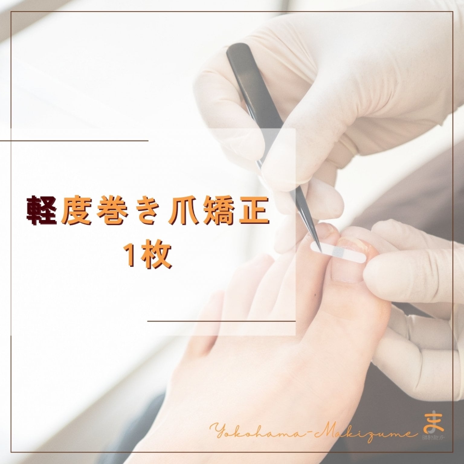 軽度｜巻き爪矯正
