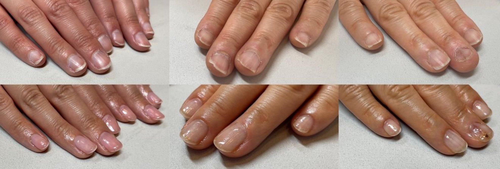 岐阜県大垣市ネイルサロン Nail Kokorone 深爪さんの駆け込みサロン
